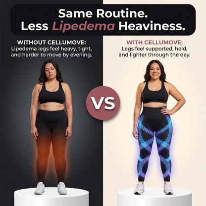 Oliron ShapeFlex™ 3D Legging – Say goodbye to lipoedema pain and swelling naturally