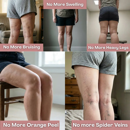 Oliron ShapeFlex™ 3D Legging — Daily lymphatic drainage