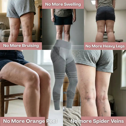 Oliron ShapeFlex™ 3D Legging — Daily lymphatic support