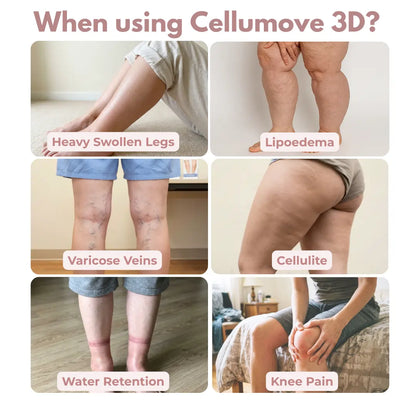 Oliron ShapeFlex™ 3D Legging — Daily lymphatic drainage