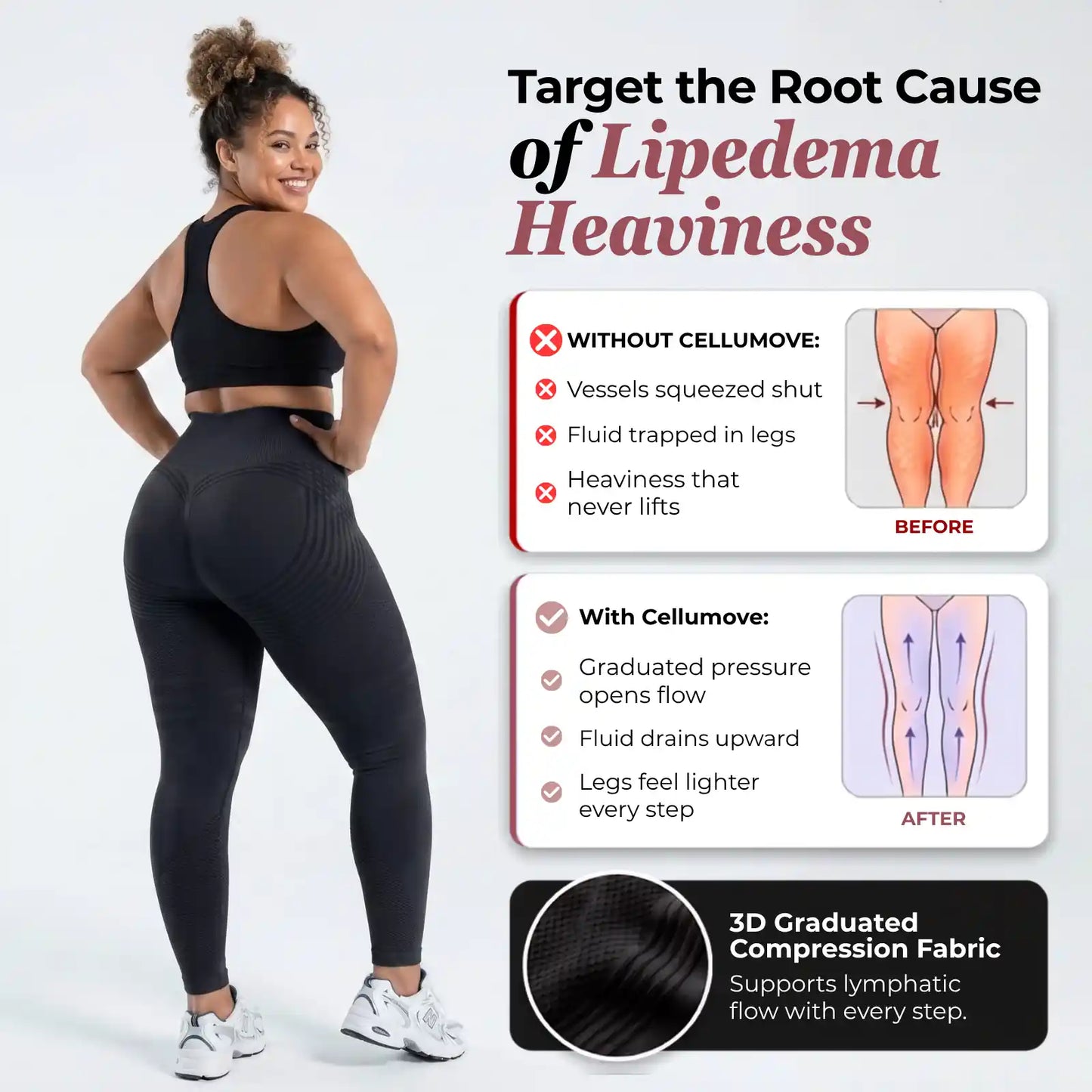 Oliron ShapeFlex™ 3D Legging – Say goodbye to lipoedema pain and swelling naturally
