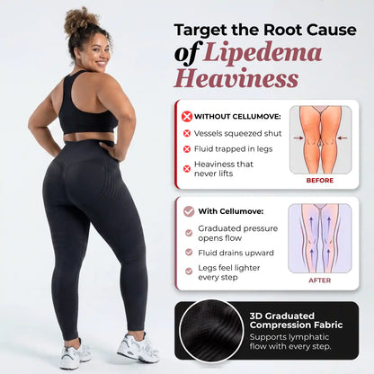 Oliron ShapeFlex™ 3D Legging – Say goodbye to lipoedema pain and swelling naturally
